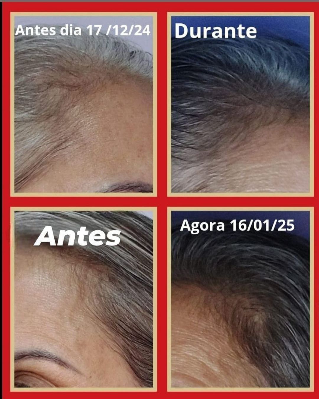 Sequência de evolução capilar