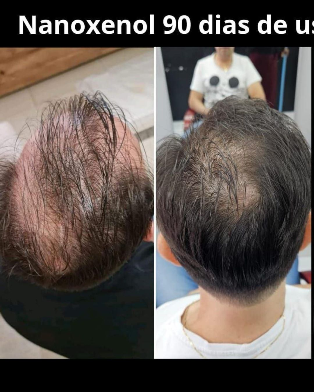 Evolução após uso contínuo