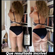Resultado antes e depois celulite