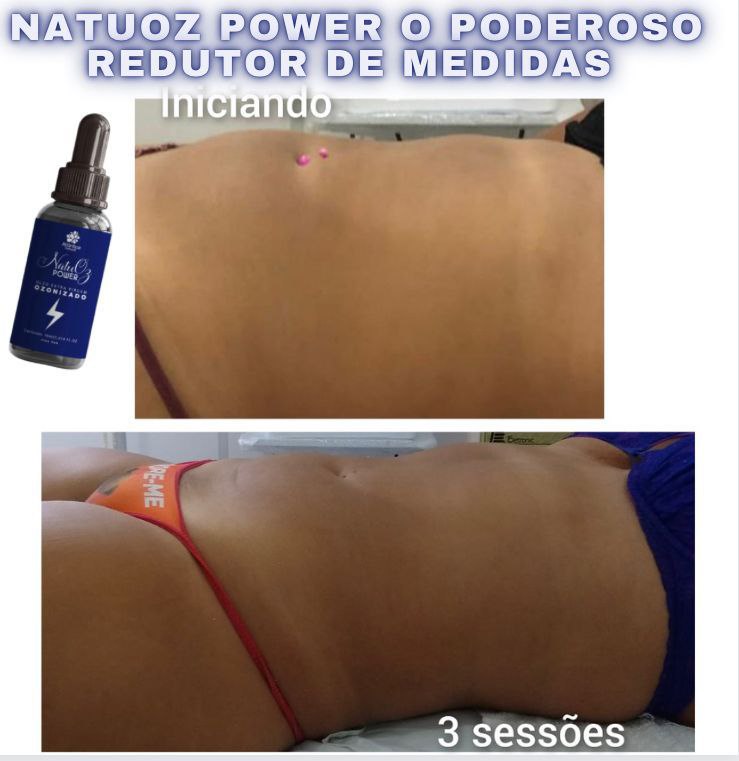 Resultado redução de medidas