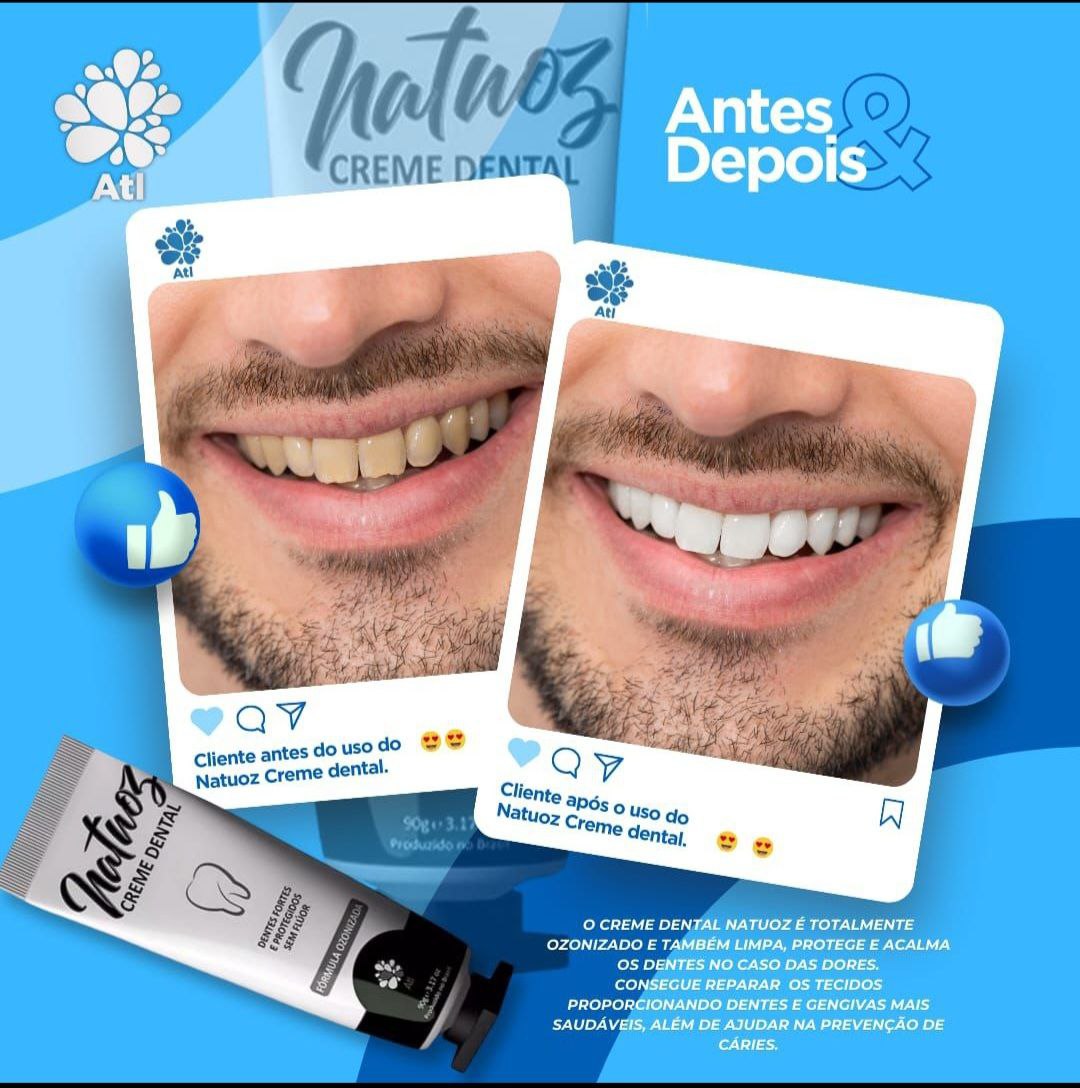 Resultado clareamento dental