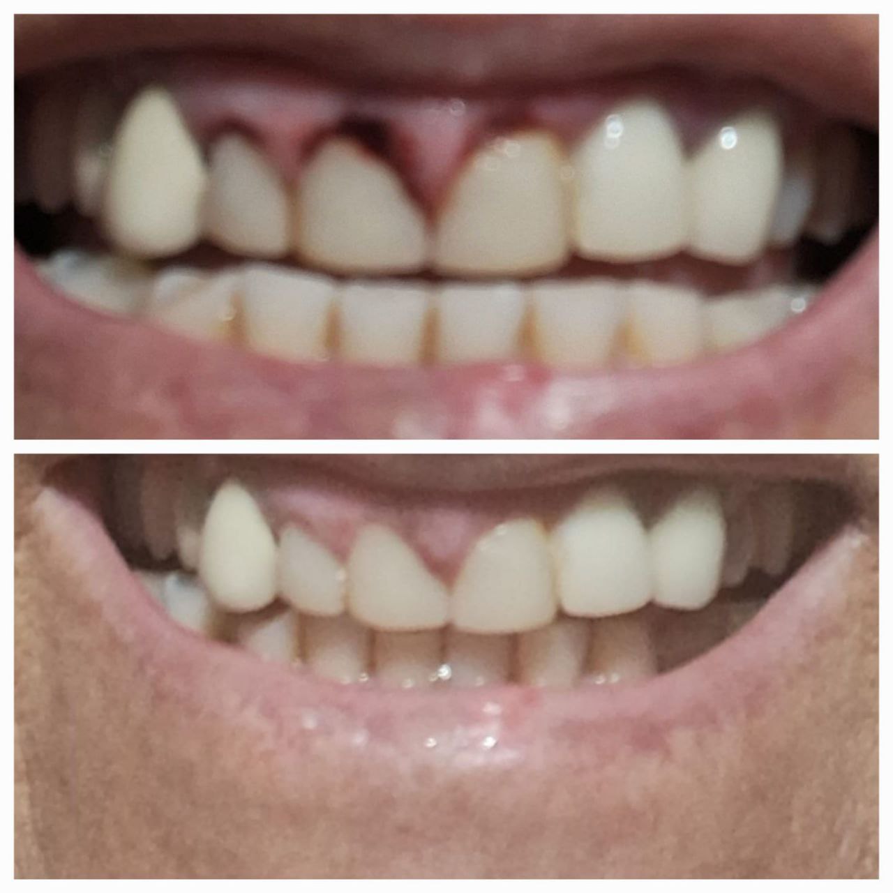 Recuperação pós-cirúrgica