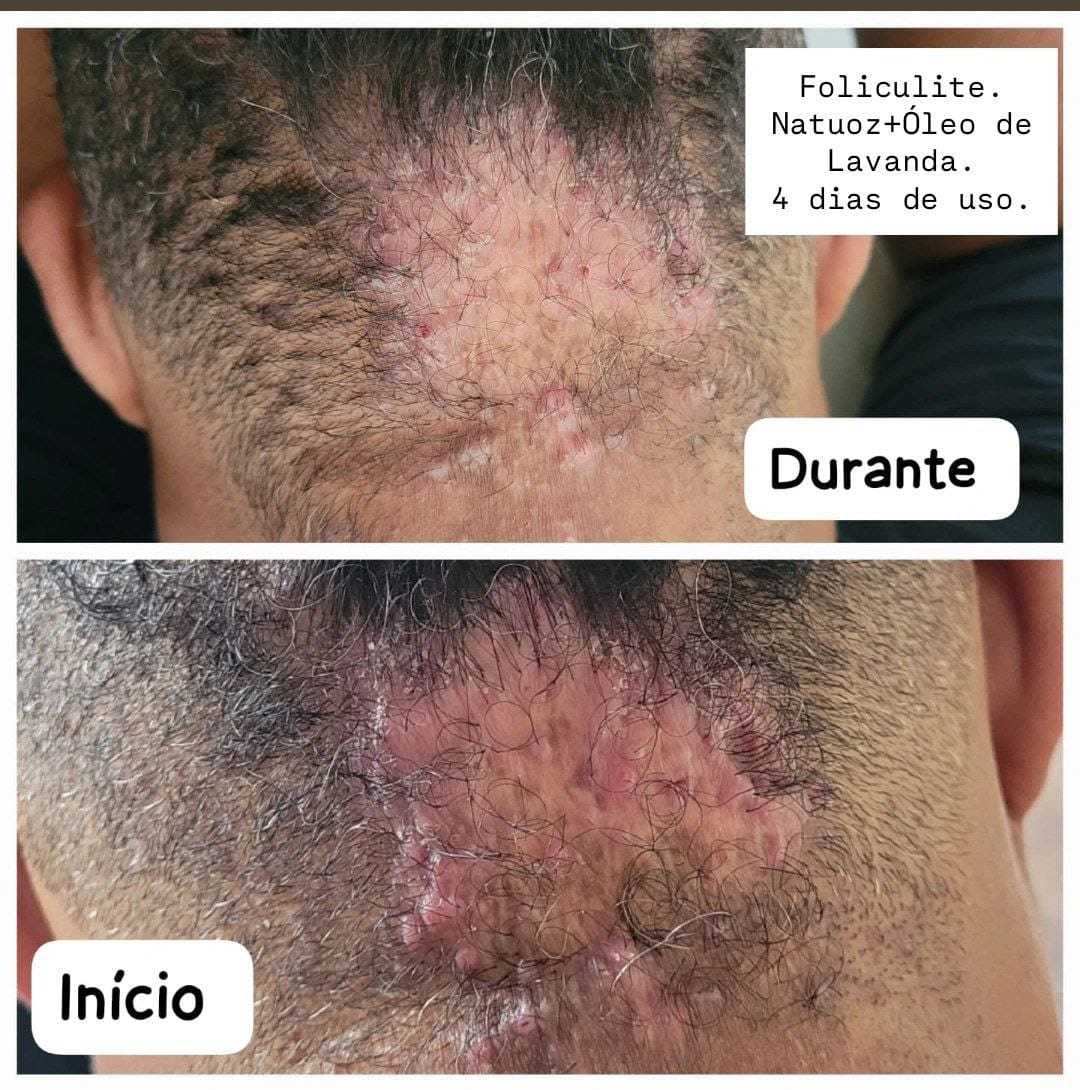 Evolução observada 2