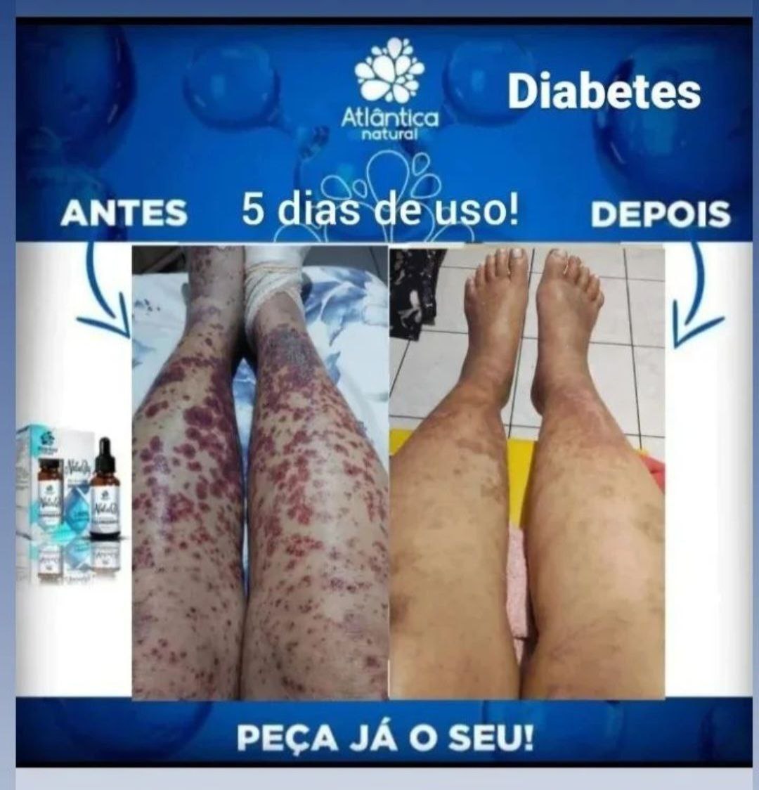 Evolução observada 6